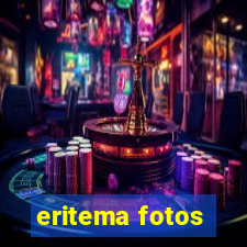 eritema fotos